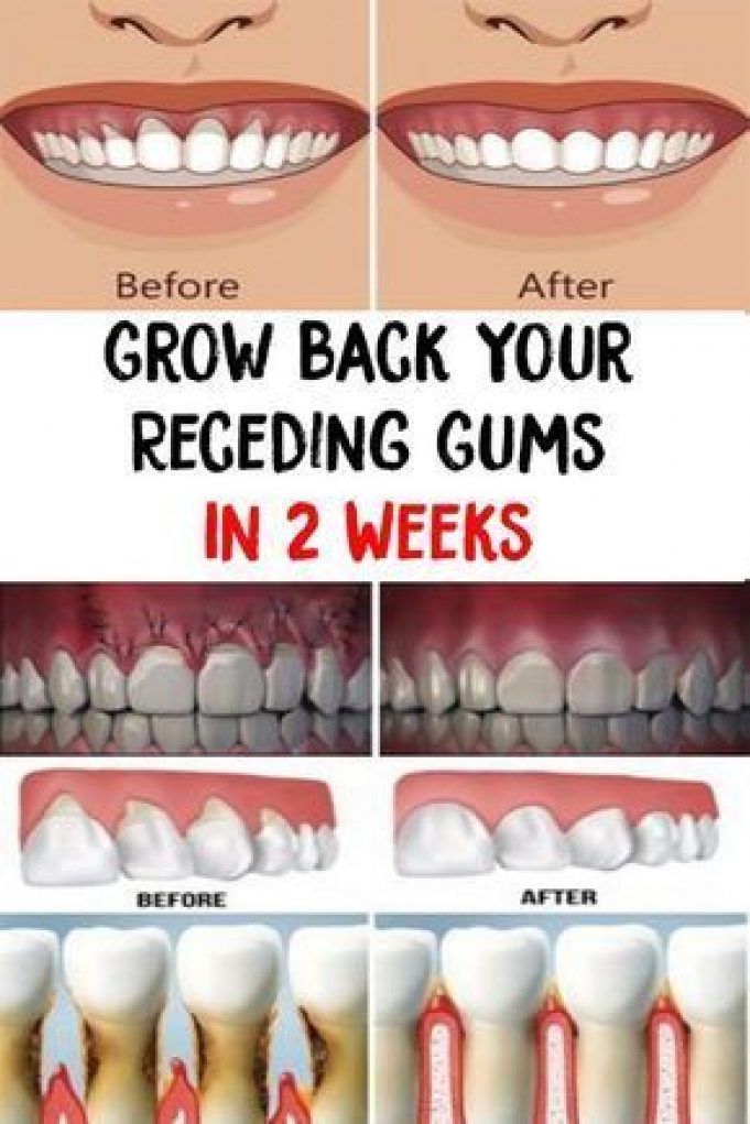 Now You Can Grow Your Teeth Back - Global Village Space